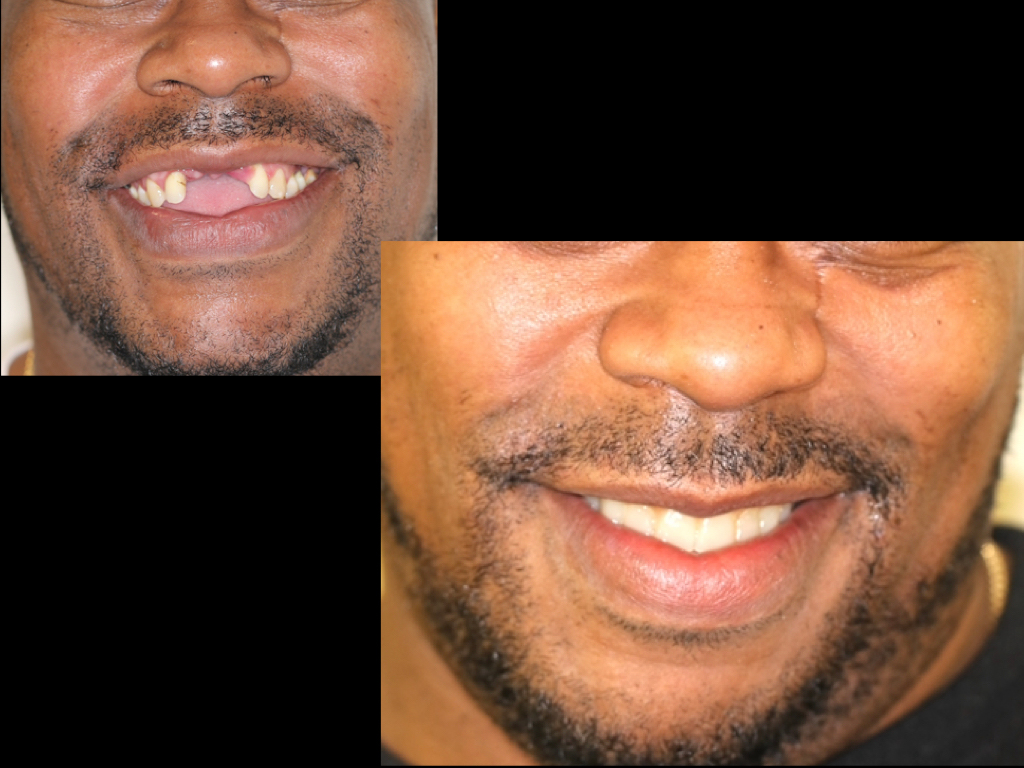 Azar Implant Dentistry | Teeth Whitening, Digital Radiography and All-on-4 reg 